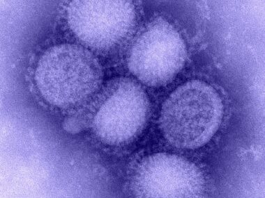 Virus H1N1