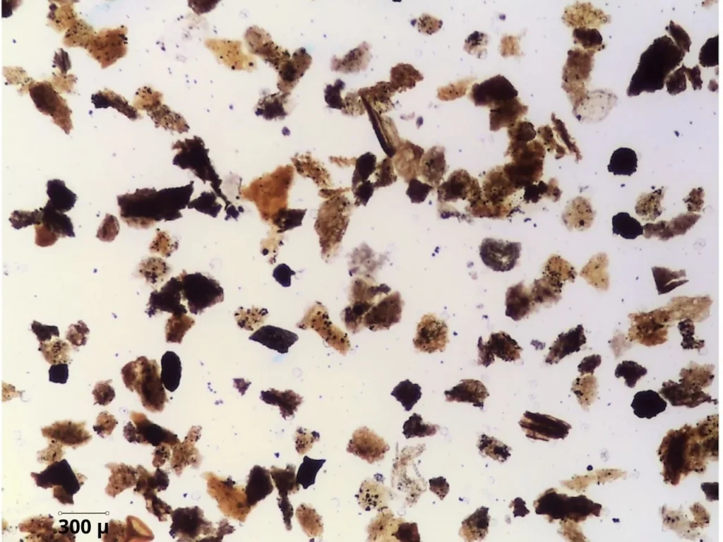 Palinomacerali visti al microscopio ottico a luce riflessa (la barra indica 300 μ). Foto di S: Cirilli