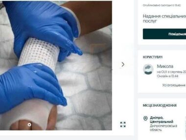 In Ucraina non si fanno gessi finti, ma fratture a pagamento per ingessature vere.